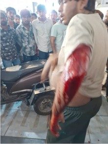 જામનગરના જૂની અનુપમ ટોકીઝ વિસ્તારમાં કપડાં ખરીદવા આવેલા યુવાન પર છરીથી જીવલેણ હુમલો