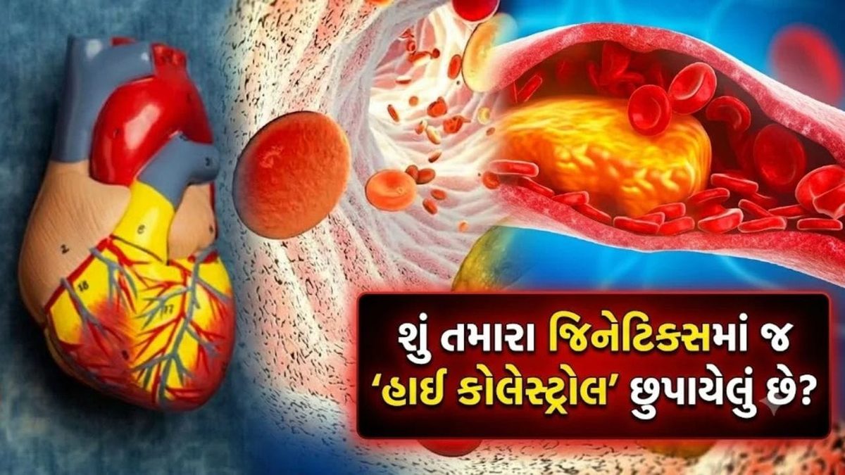 જિનેટિક્સમાં રહેલું હાઈ કોલેસ્ટ્રોલનું જોખમ સારા આહારથી ઘટાડી શકાશે, નવા સંશોધનમાં ખુલાસો