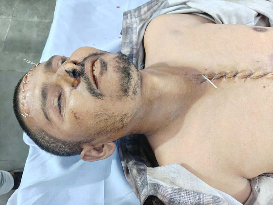 શાપર વેરાવળમાં રખડતા શ્વાને બટકું ભરતા 32 વર્ષના યુવકનું સારવાર દરમિયાન કમનસીબ મોત