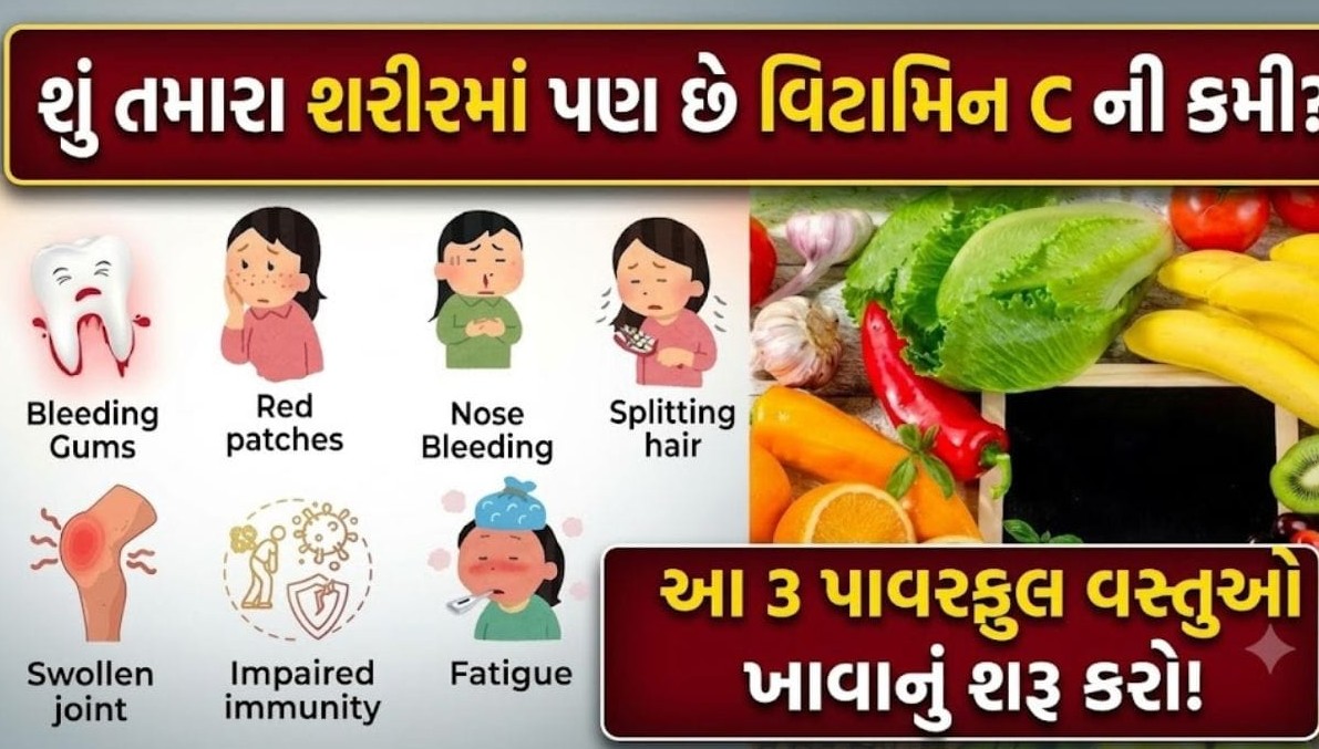 શરીરની રોગપ્રતિકારક શક્તિ વધારવા અને ચમકદાર ત્વચા મેળવવા માટે વિટામિન સી થી ભરપૂર આહારનું સેવન અનિવાર્ય: નિષ્ણાતોની સલાહ