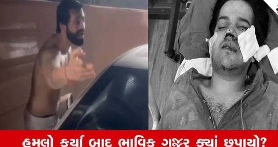 અમદાવાદમાં કાર રોકવા જેવી નજીવી બાબતે યુવક પર ઘાતકી હુમલો, પાન પાર્લર સંચાલક સામે ગુનો દાખલ