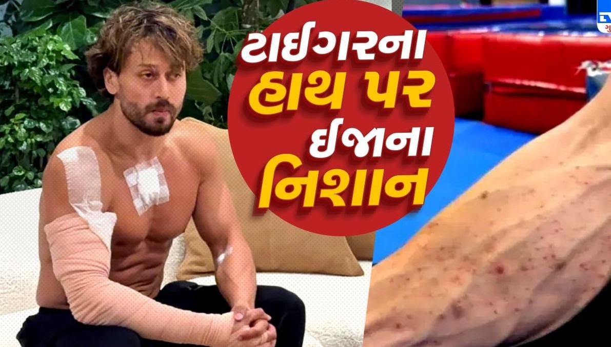 બોલિવૂડ અભિનેતા ટાઈગર શ્રોફ પર હુમલો: માતાએ શેર કરી ઈજાની તસવીર, ચાહકોમાં ચિંતા