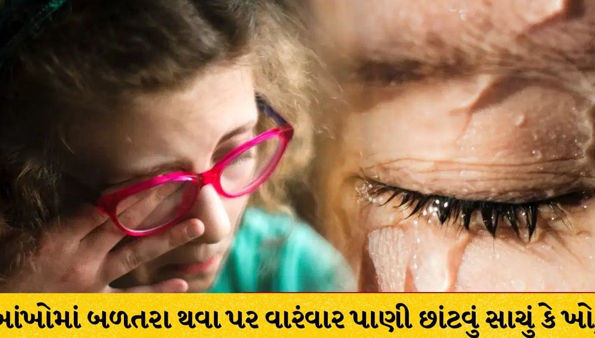 આંખોમાં બળતરા પર વારંવાર પાણી છાંટવું કેટલું યોગ્ય? જાણો નિષ્ણાત ડૉક્ટરની સલાહ અને બચાવના સાચા ઉપાયો