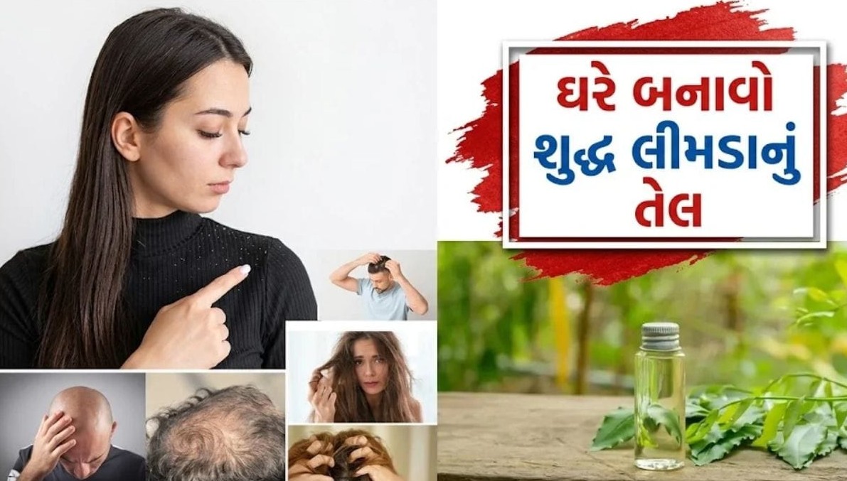 ઘરે બનાવો શુદ્ધ લીમડાનું તેલ, વાળની તમામ સમસ્યાઓથી મળશે કાયમી છુટકારો